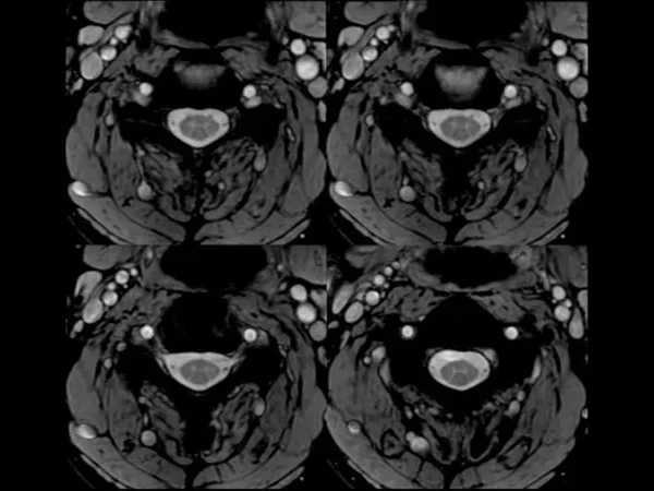 3T MRI 5
