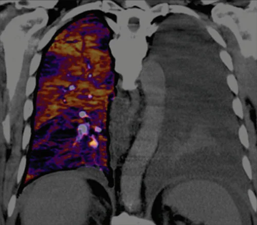 CT Scan 2