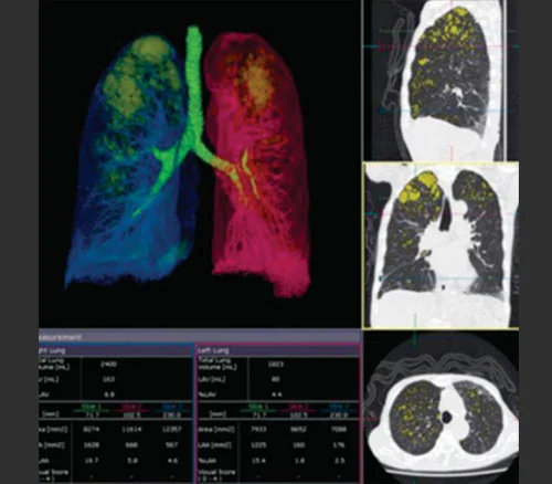 CT Scan 3