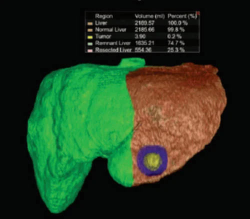 CT Scan 4