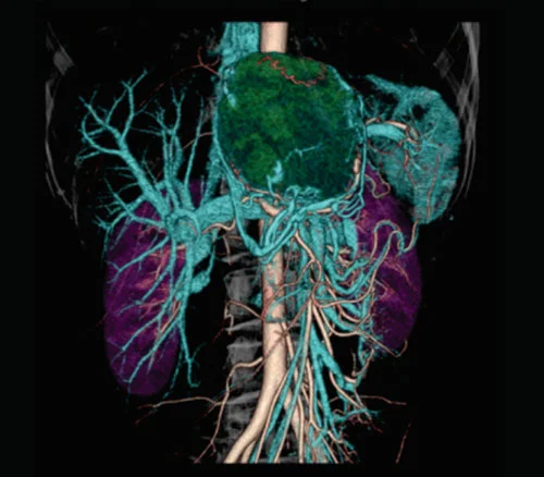 CT Scan 5