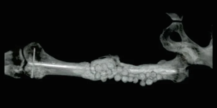 CT Scan 6