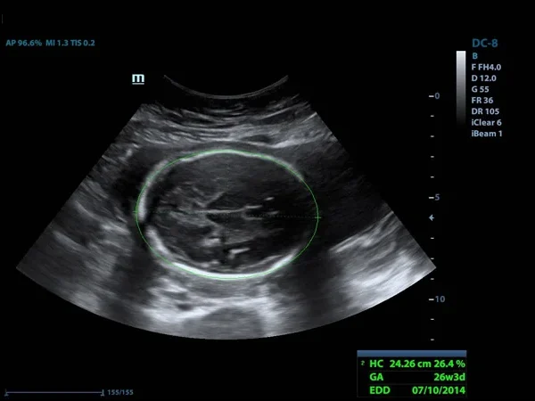 Ultrasound(USG) 2