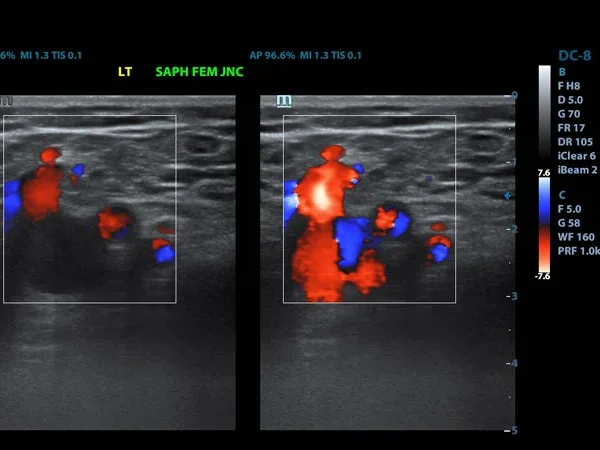 Ultrasound(USG) 3