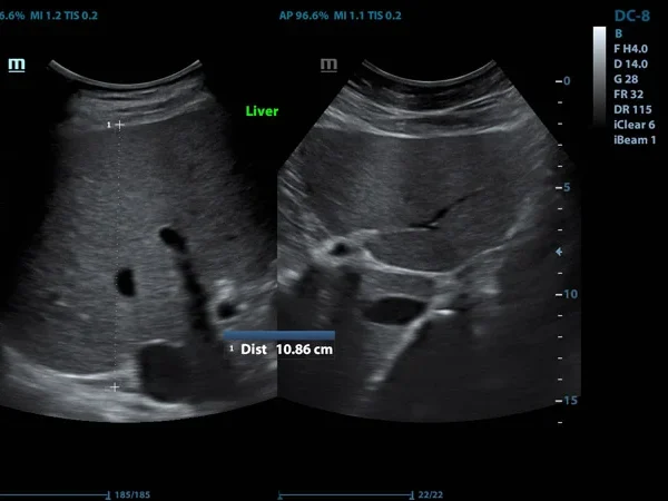 Ultrasound(USG) 4