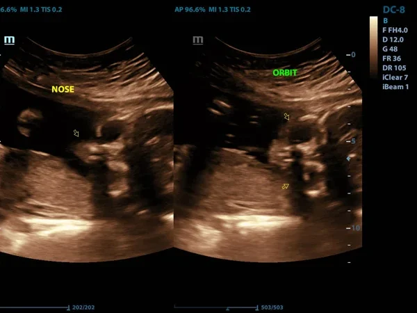 Ultrasound(USG) 5