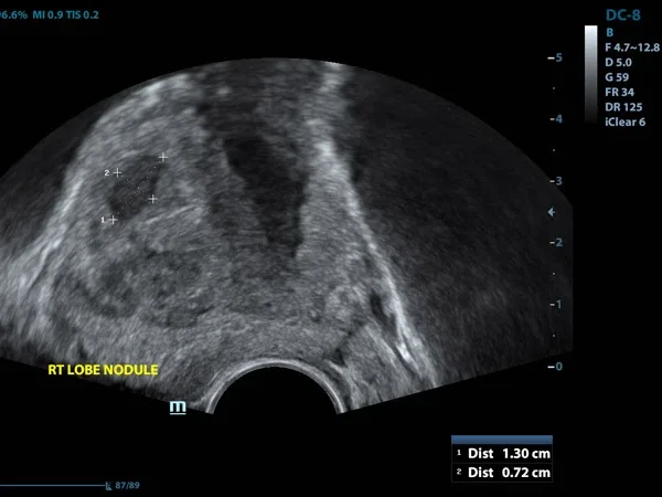 Ultrasound(USG) 6