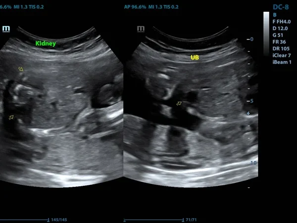 Ultrasound(USG) 7