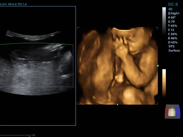 Ultrasound(USG) 9