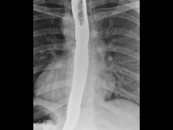 Contrast Procedures 1