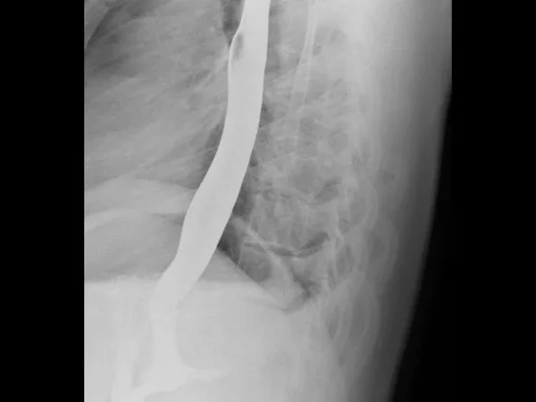 Contrast Procedures 7