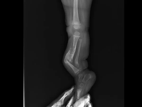 Digital X-ray 5
