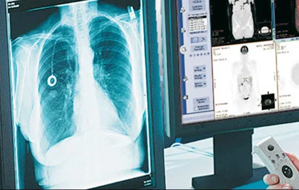 Tele Radiology 1