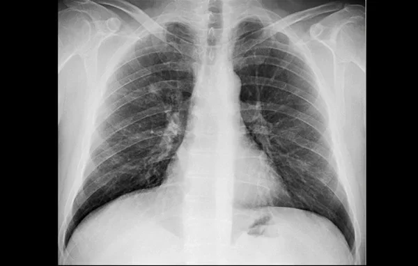 Tele Radiology 2