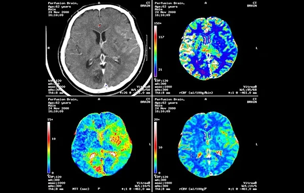 Tele Radiology 4