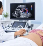 Color Doppler